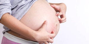 Vulva Itching During Pregnancy: Safe Natural Remedies That Work