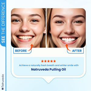 Oil Pulling for Gum Health: Reducing Gingivitis and Bleeding Gums Naturally